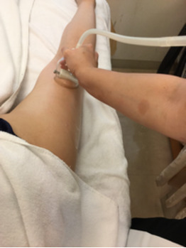 セルライト自分で潰してないですか 年07月25日 12時23分 スリムビューティハウス 赤羽店ブログ Eparkリラク エステ