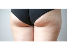 脂肪細胞とセルライトの違いって 年08月04日 12時01分 スリムビューティハウス 盛岡店ブログ Eparkリラク エステ