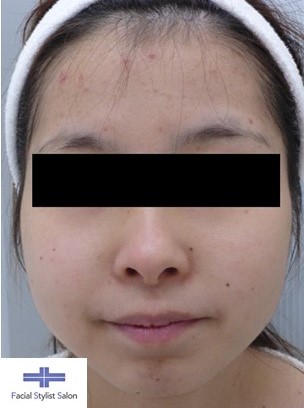 正しいスキンケア方法 21年06月01日 10時48分 肌能力回復フェイシャルスタイリストサロン高崎店ブログ Eparkリラク エステ