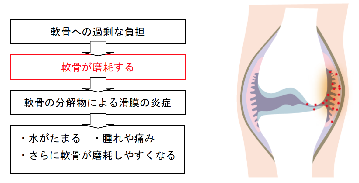 膝が痛い O脚は嫌だ いつまでも綺麗な脚でいたいあなたへ 19年04月10日 18時00分 整体院 Oasisブログ Eparkリラク エステ