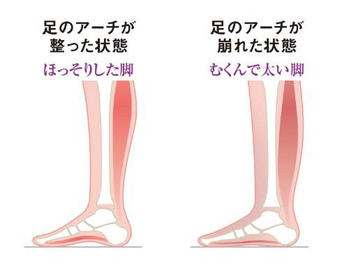 むくみの見方 19年05月02日 15時16分 Salon De Ozブログ Eparkリラク エステ