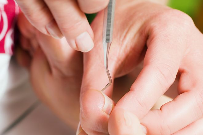 ドクターネイル 爪革命 札幌麻生店 札幌市北区北三十六条西 麻生駅 フットケアのお店 こだわり バイタルなび